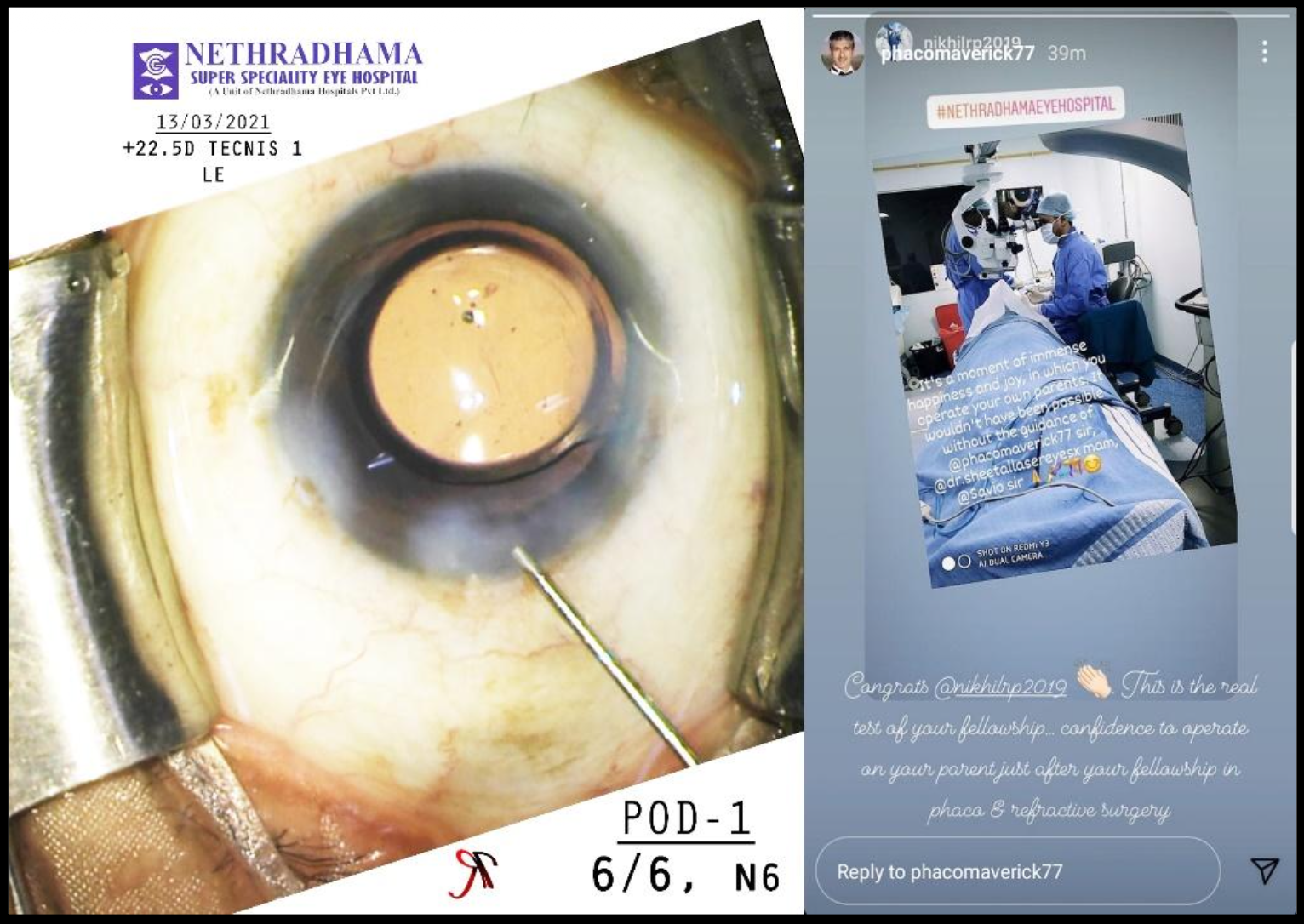 Intra-OP Image 1